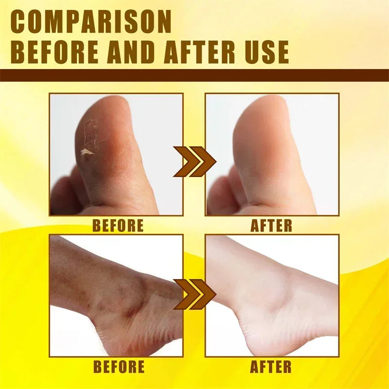 Yellow Peeling Oil Body Cleansing Exfoliation For Tender Glowing Skin Finger Joint Whitening Moisturizing Care Beauty Products
