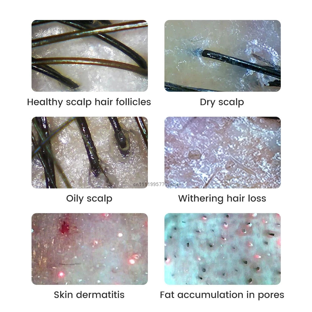 1000 times Wireless Dermatoscope Scalp Skin Analyzer Machine Facial and Body Analyzer Electronics Microscope Beauty Health Pro