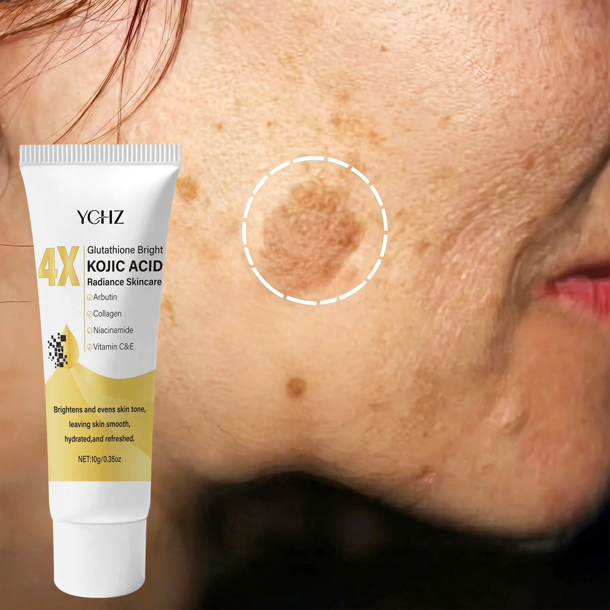 Kojic Acid Face Cream, Evens Out Skin Tone, Eliminates Dark Spots and Dullness - Non-Greasy, Suitable for Both Men and Women - Whitening and Moisturizing Cream, for Day and Night Use, Ideal Holiday Gift