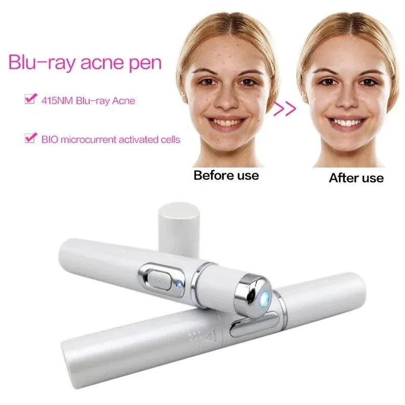 Facial Beauty Device Eye Blue Light Black Eye Circles Facial Care Tool Lightening Texture Maintaining Eye Bags