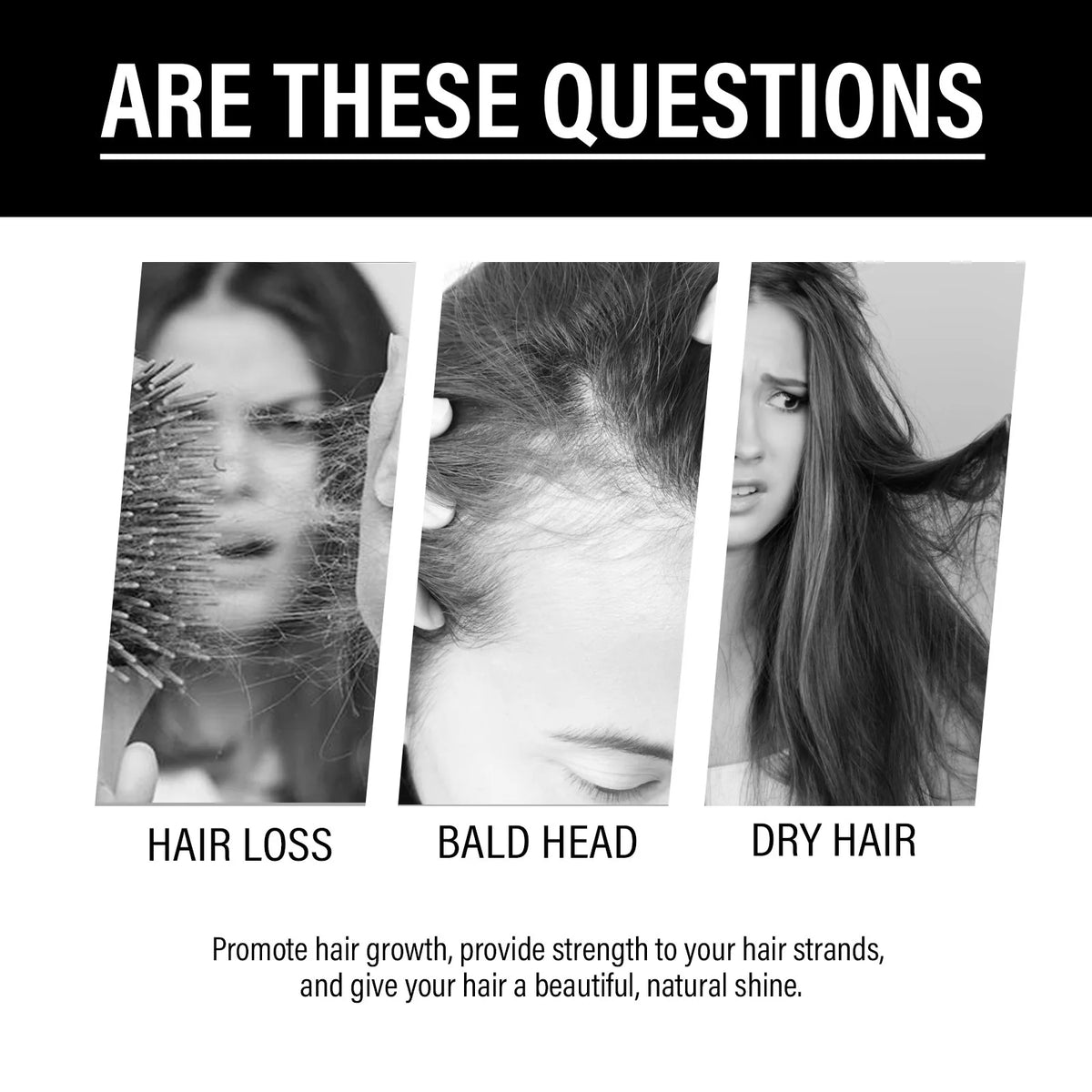 Anti-Hair Loss Essence Serum Promotes Hair Growth Improves Scalp Environment Hair Care