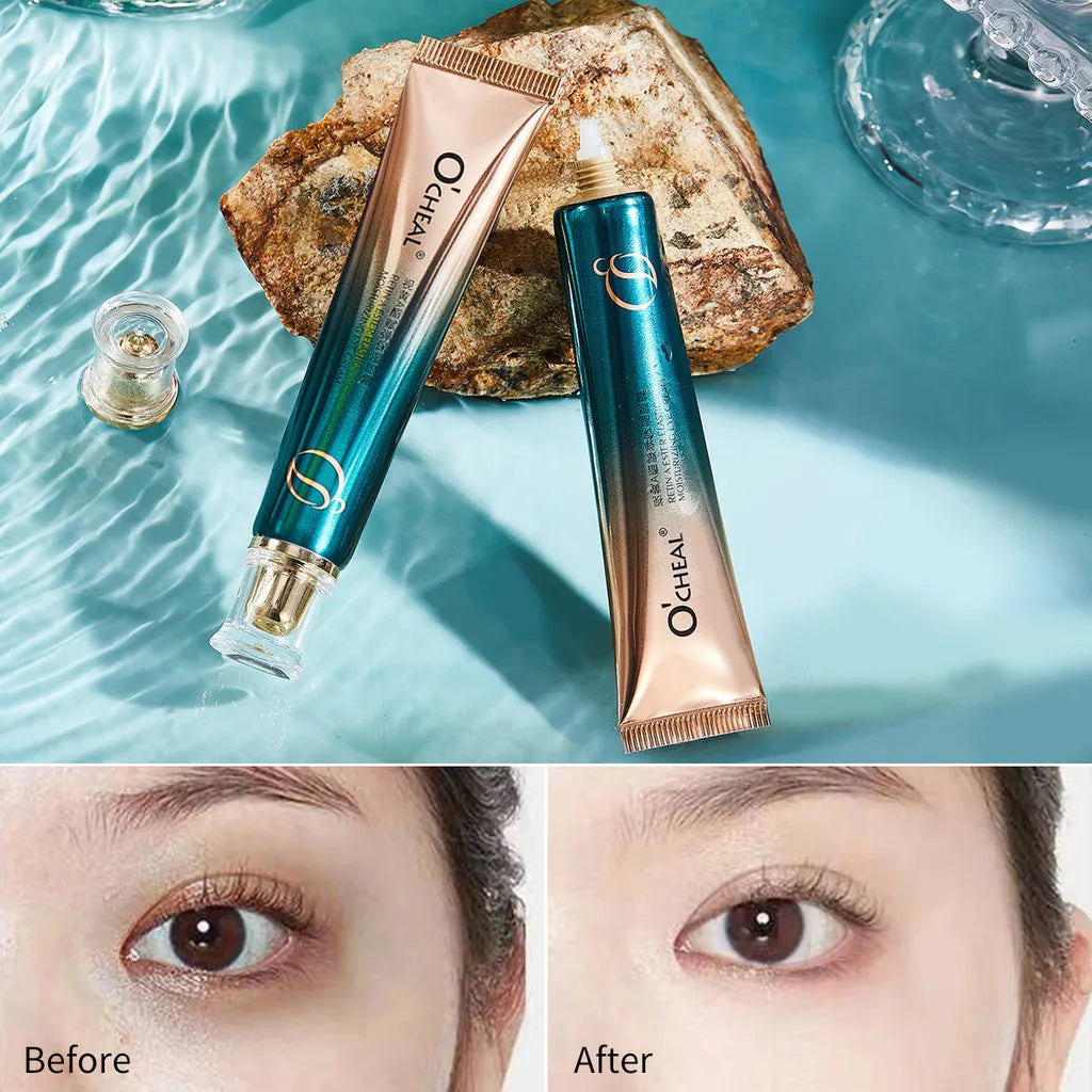 Retinol A Ester Elastic Moisturizing Firming Eye Cream Fading Fine Lines Dark Circles 30g