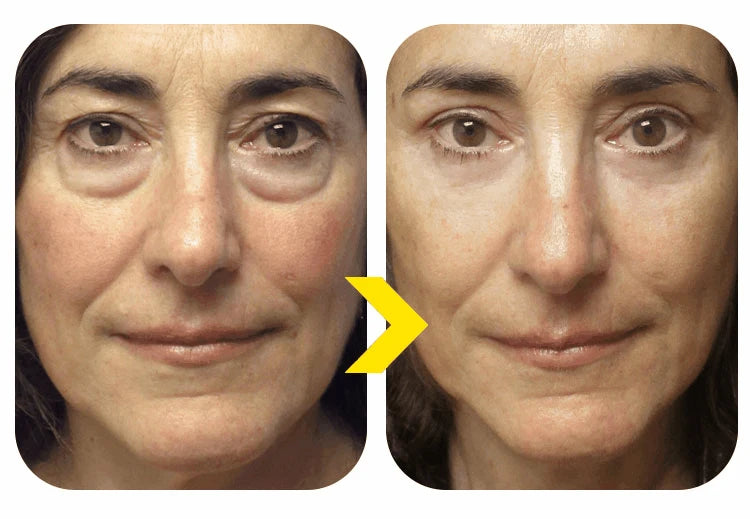 2026 Bestselling Eye Care Tool - Eye Revitalizing Cream (Free Shipping)