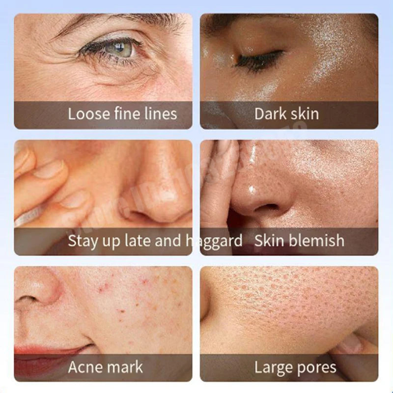10pcs Copper Peptide Algae Peeling Whitening Melasma Peel Kit Natural Seaweed Bone Plant Extract Mask Rejuvenation Moisturize