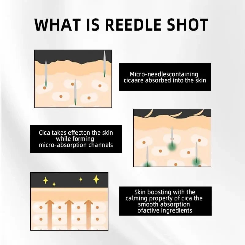 Korean Microneedle Essence Desalination Fine Lines Spots Collagen Solution Reverse Aging Recombinant Improves Rough Texture 50ml