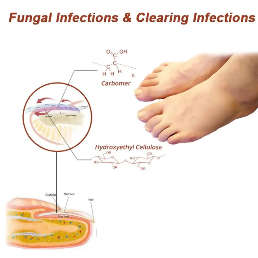 Nail Care Device Nails Fungal Treatment Repairing Thickened Gray Nails Relieve Ingrown Nail Cleaning Tools Foot Health Care