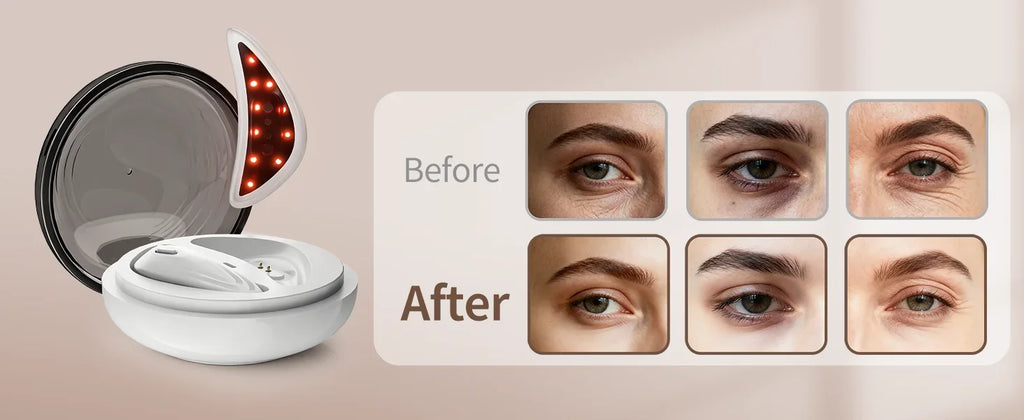 EMS Facial Eye Beauty Device With Gel Patches Red Light Eye Firming Massage For Eye Care Reducing Eye Bags Dark Circles