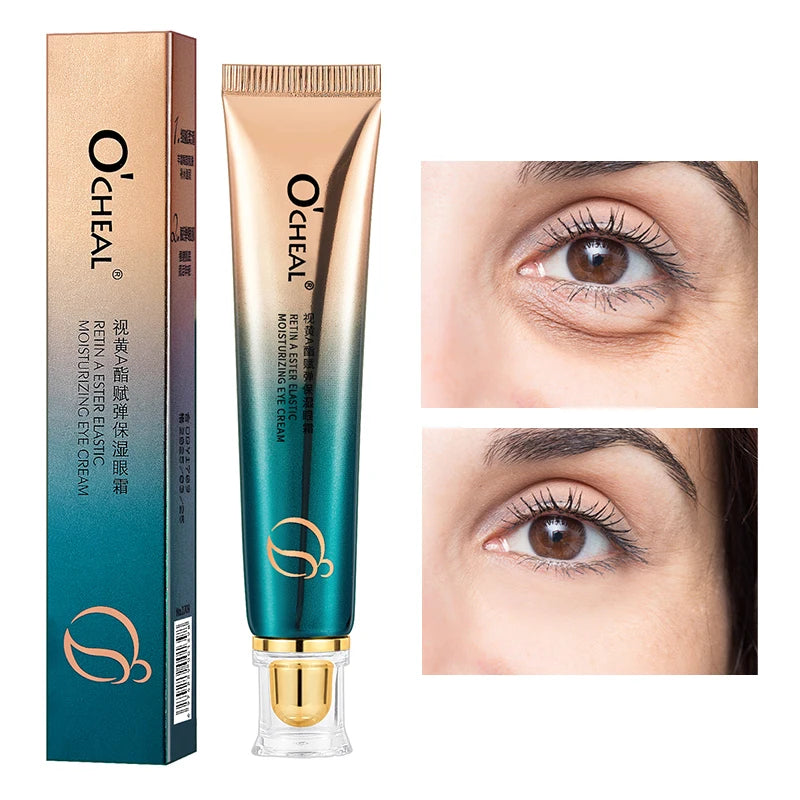 Eye Anti-Wrinkle Cream Fades Fine Lines Anti Dark Circles Eye Serum Remove Eye Bag Puffiness Anti-Aging Firmness Eye Care OCHEAL