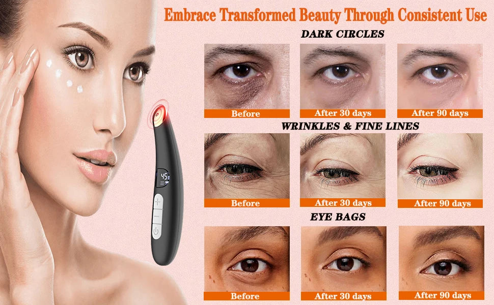 Eye Beauty Device 3 in 1 Eye Massager Wand with Red LED Light Vibration Massage Portable Beauty Machine Electric Eye Care Tool