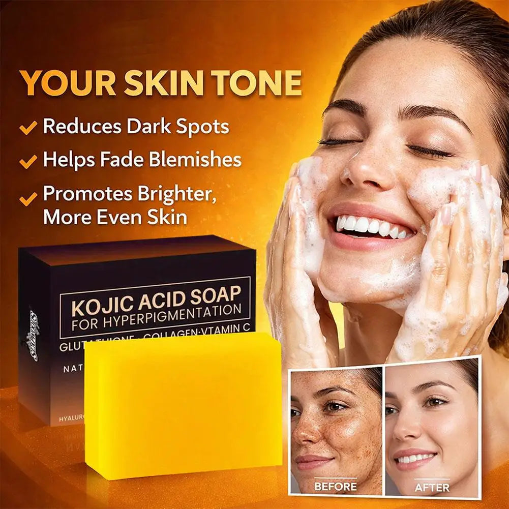Pure Kojic Acid & Turmeric Soap Bar 100g,Skin Brightening Bar for Face & Body, Helps Improve Uneven Skin Tone, Dark Spots & Acne