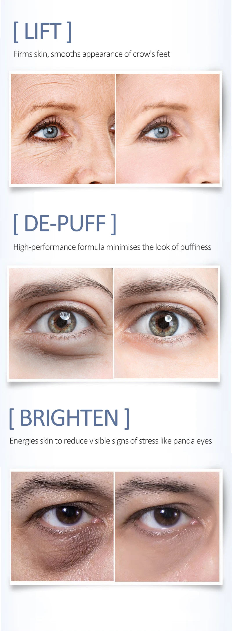 Eye Anti-Wrinkle Cream Fades Fine Lines Anti Dark Circles Eye Serum Remove Eye Bag Puffiness Anti-Aging Firmness Eye Care OCHEAL