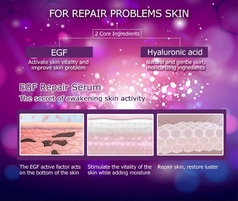ARTISCARE Serum for Face 8pcs/Lot Hyaluron Acid Moisturizing Vitamain C Facial Essence Six Peptide Q10 EGF Skin Care