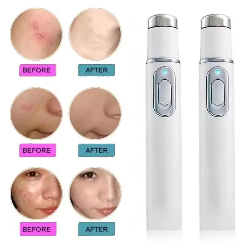 Facial Beauty Device Eye Blue Light Black Eye Circles Facial Care Tool Lightening Texture Maintaining Eye Bags