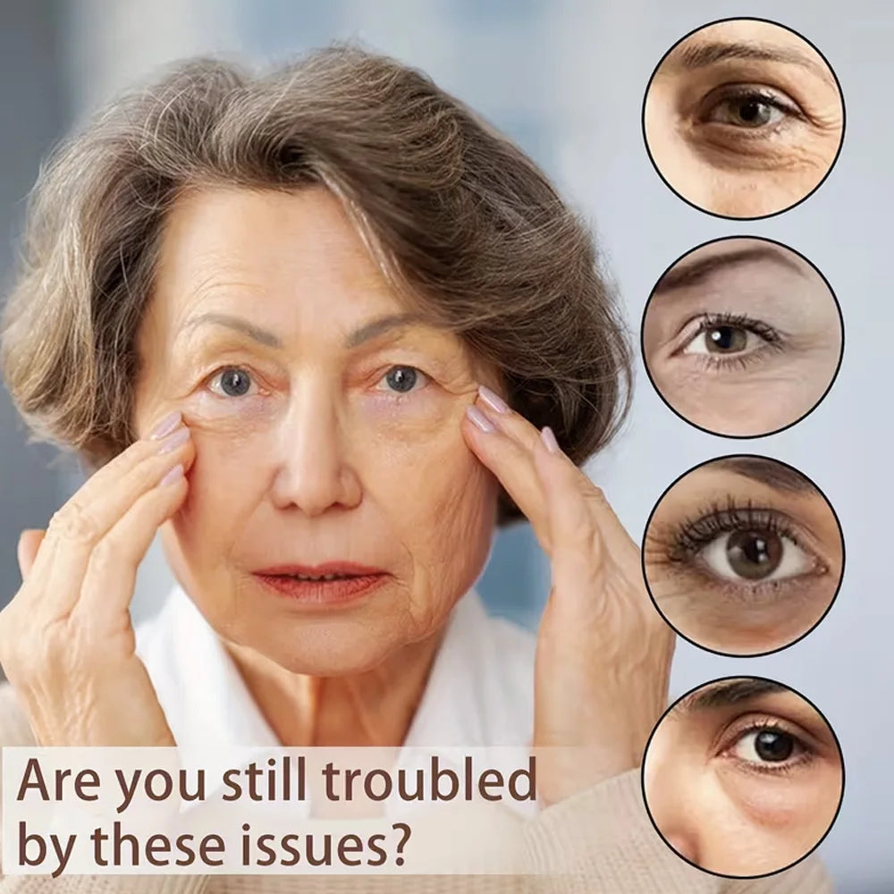 Aihuf Bee Toxin Eye Cream 15ml Instant Moisturizing Anti-Aging Deeply Nourishing Smooth Dry Skin Bag under Eye Treatment Dark Ci