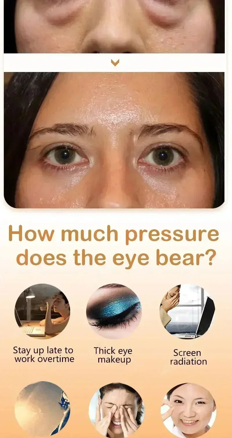 Anti-Wrinkle Remove bags Puffiness Dark Circles under eyes Lightening Fine Lines Moisturizing Whitening Skin Care
