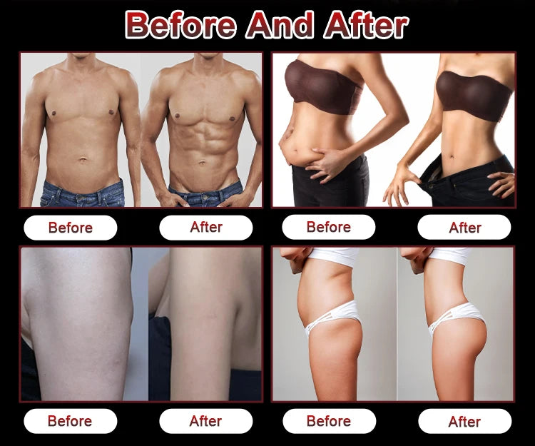 Body Sculpt Slimming Machine NEO RF Electric Muscle Stimulation Fat Removal Portable Electromagnetic Weight Loss Equipment