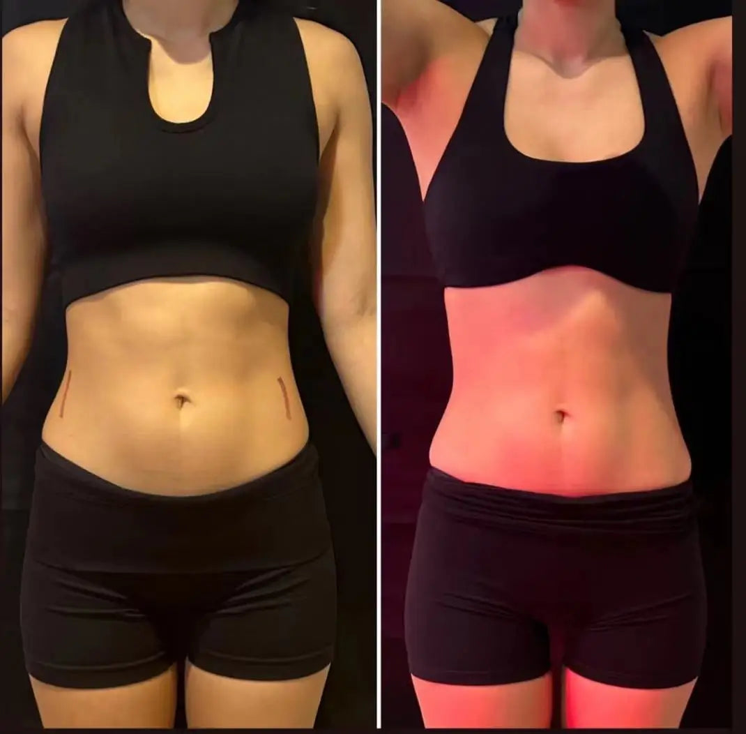 MYOslim EMS Machine EMS Body Slimming NEO Sculpting Fat Burning Nova Weight Lose Electromagnetic Muscle