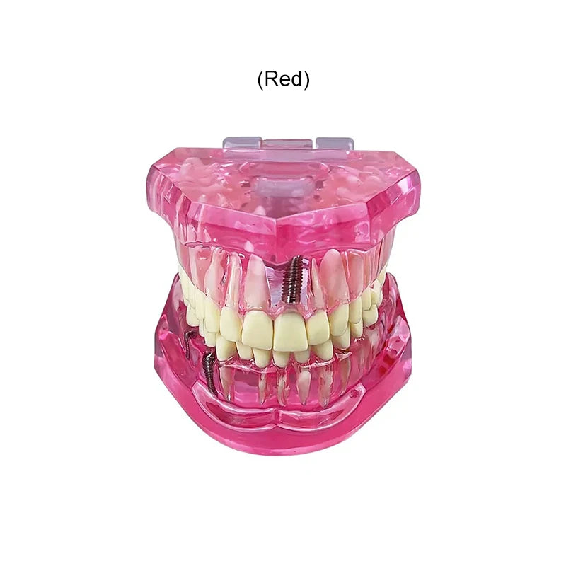 VVDental Teeth Repair Model Disease Teeth Model for Dentist Student Practice Training Studying Oral Medical Dentistry Tools