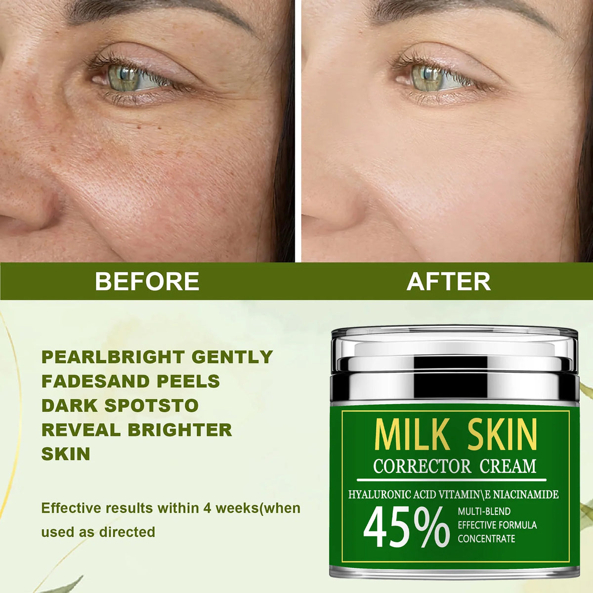 ENVISHA Dark Spot Remover Corrector for Face and Body, Dark Spot Corrector Cream,Moisturizer-Remover Sun Spot, Age Spot,Melasma,