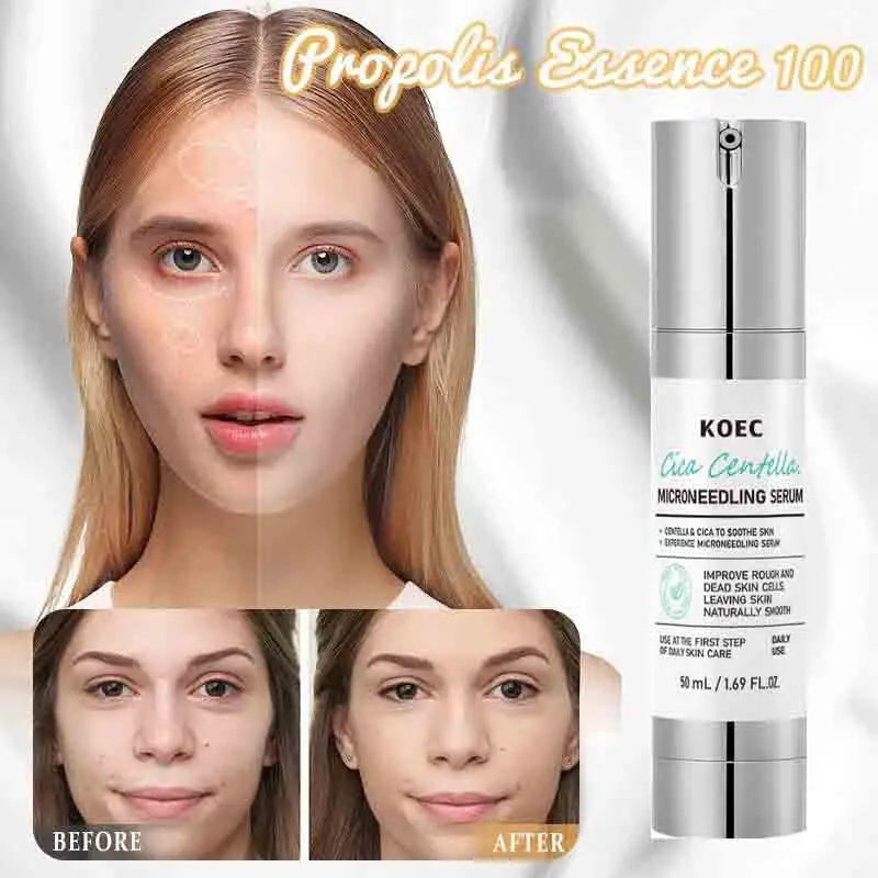 Korean Microneedle Essence Desalination Fine Lines Spots Collagen Solution Reverse Aging Recombinant Improves Rough Texture 50ml