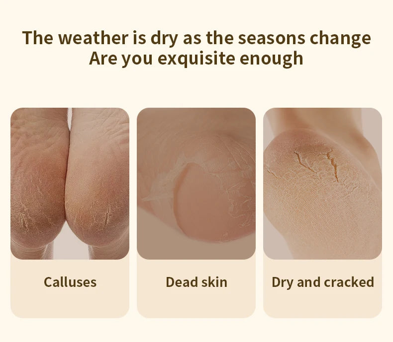 HOMEFISH Electric Foot Grinder Automatic Foot Callus Rubbing Pedicure Dead Skin Callus Remover for  Foot Beauty Machine