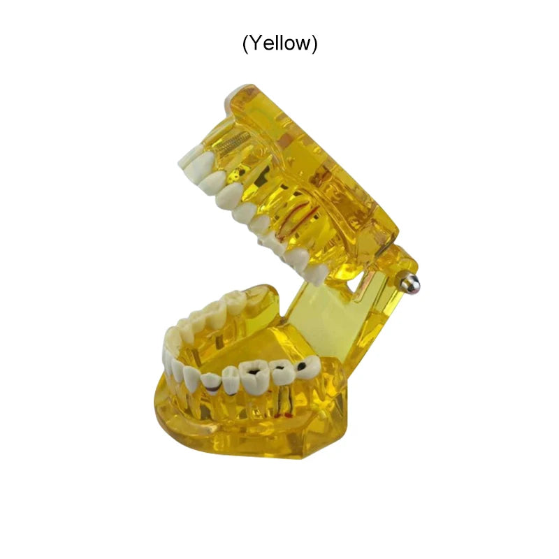 VVDental Teeth Repair Model Disease Teeth Model for Dentist Student Practice Training Studying Oral Medical Dentistry Tools