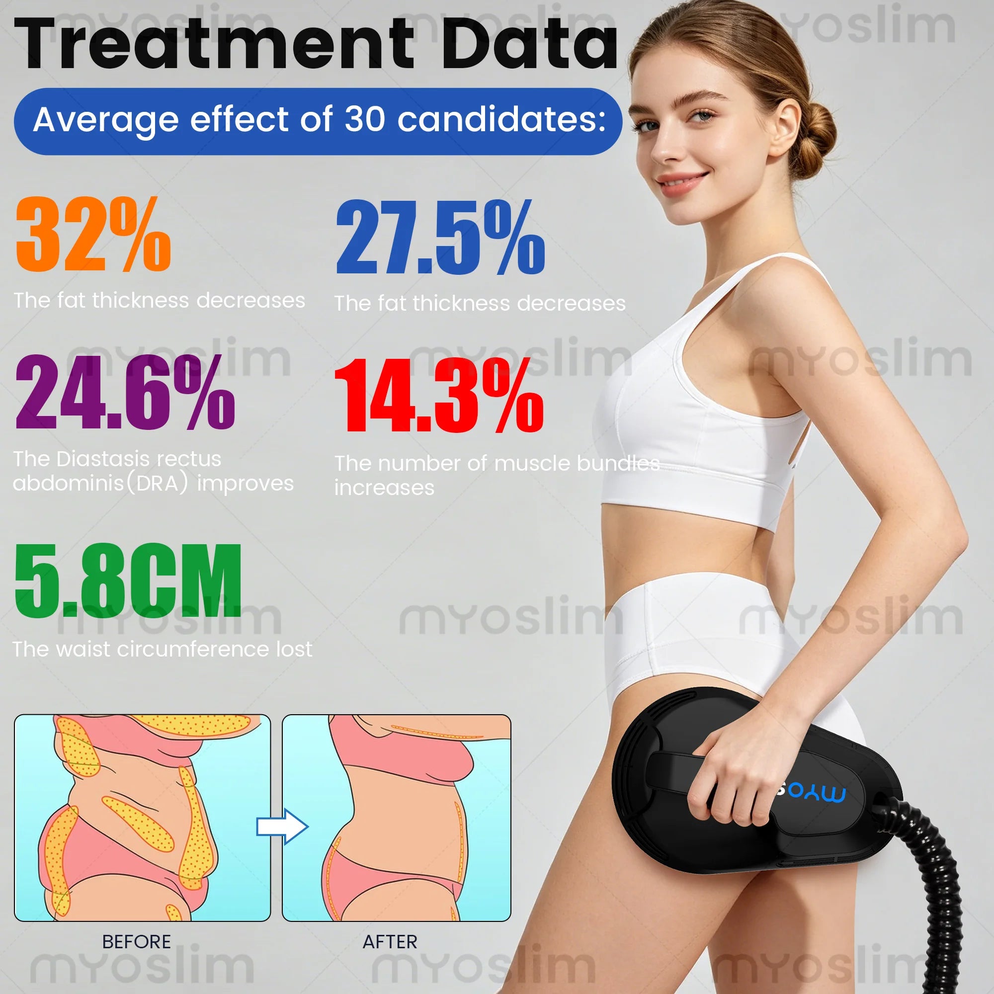 EMS 6500W Body Sculpting Machine RF Muscle Building Fat Reduction Slimming Beauty Salon Equipment 200Hz 15T Abdominal Hips Lift