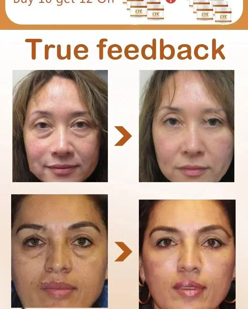 Anti-Wrinkle Remove bags Puffiness Dark Circles under eyes Lightening Fine Lines Moisturizing Whitening Skin Care