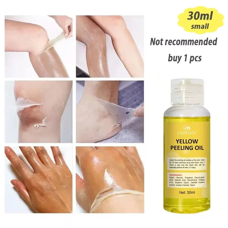 Yellow Peeling Oil Body Cleansing Exfoliation For Tender Glowing Skin Finger Joint Whitening Moisturizing Care Beauty Products