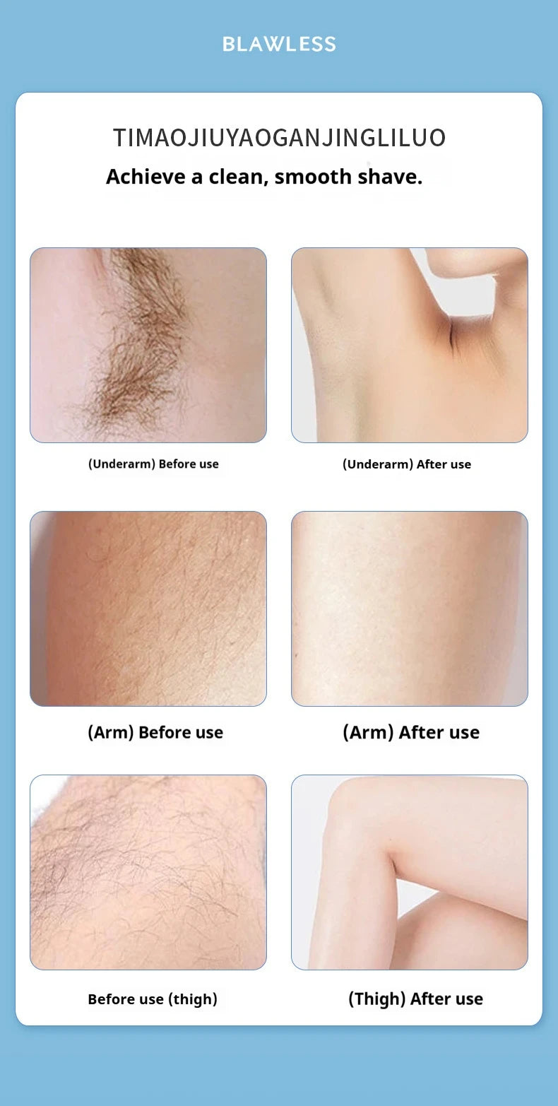 Women's Electric Shaver Painless Hair Remover for Face Bikini Underarms Legs Body Portable Epilator