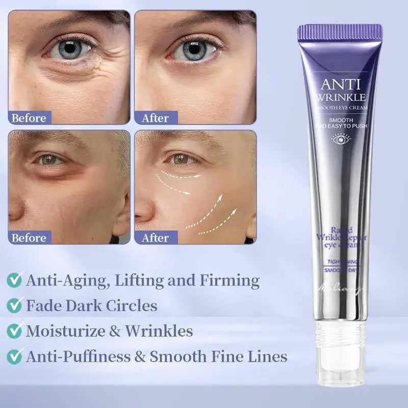 Anti Wrinkle Anti Dark Circle Eye Cream Roller Massager Moisturizing Eye Bags Anti Aging Hyaluronic Acid Eye Skin Care