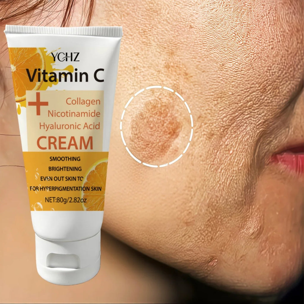Vitamin C Niacinamide Dark Spot Brightening Cream |   Collagen and Niacinamide Face Cream - Whitening and Brightening Cream, Brightens Skin Tone, Evens Skin Tone, Suitable for Face and Body - 80g