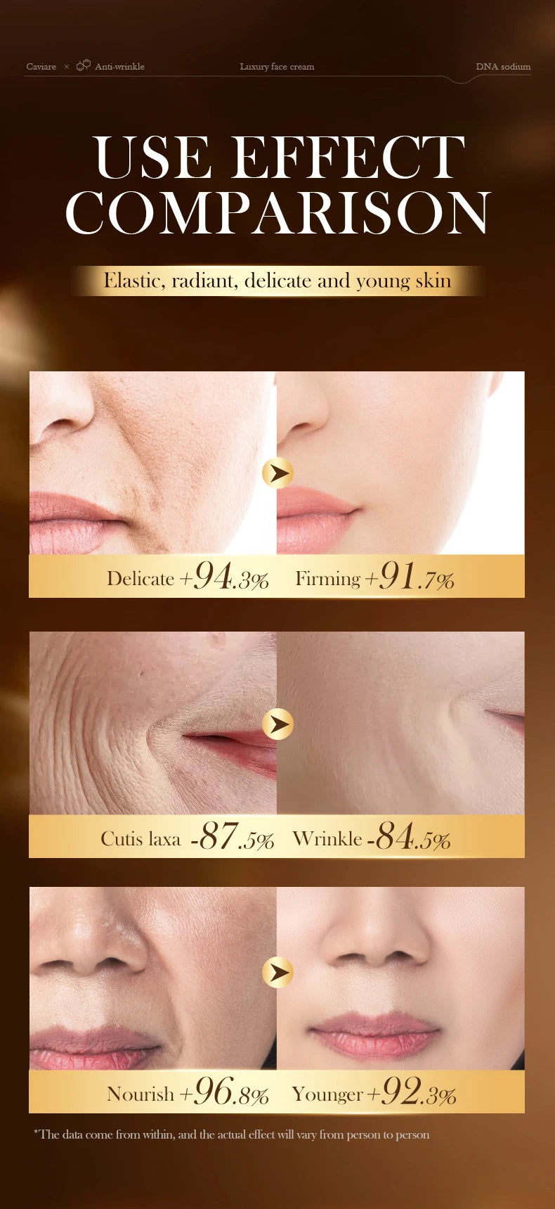 Caviar Firming Wrinkles Face Cream Collagen Lightening Fine Lines Deep Hydration Moisturizing Smooth Brighten Skin Care Products