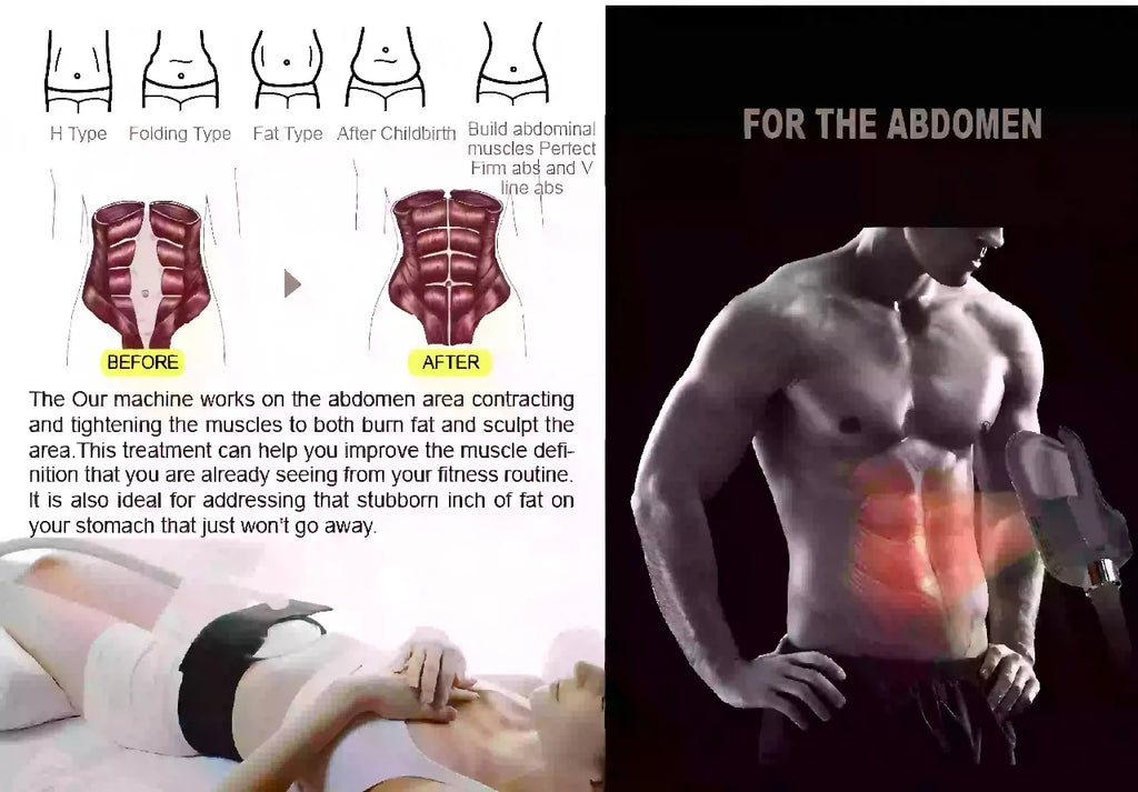2026 Portable Body Slimming Machine Upgrade 15T Muscle Trainer RF for Home Use 36000 Contractions Session Portable Body Toner Fo