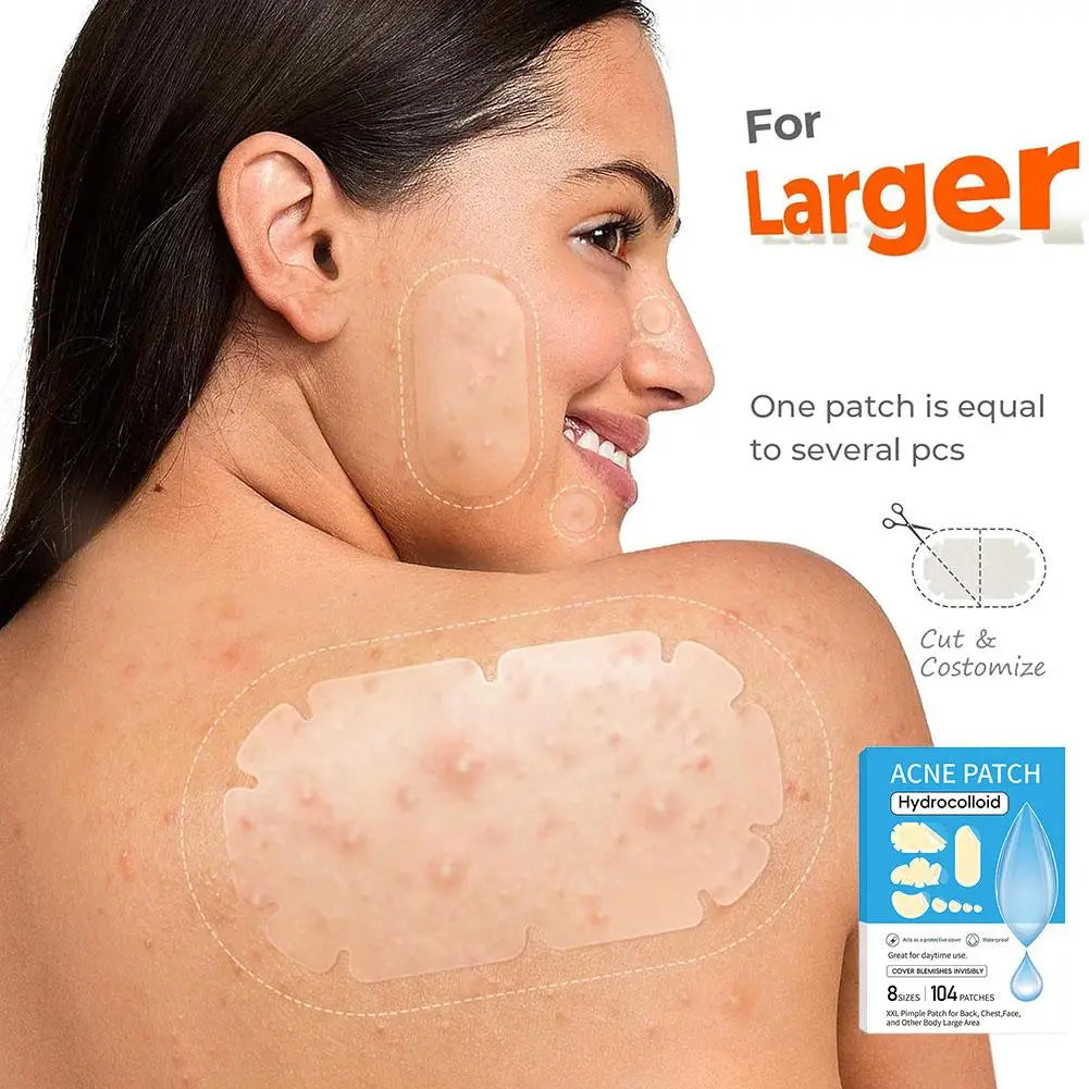 Hydrocolloid acne patch Invisible Pimple Removal Anti-Acne Patches Spots  Gentle Transparent Acne Patch face Skin Care