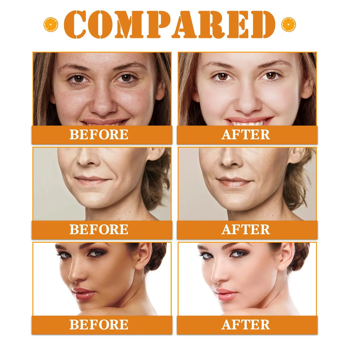 Vitamin C Whitening Serum Face Remove Dark Spots Freckles Fade Melanin Retinol Anti-wrinkle Essence Brightening Korean Skin Care