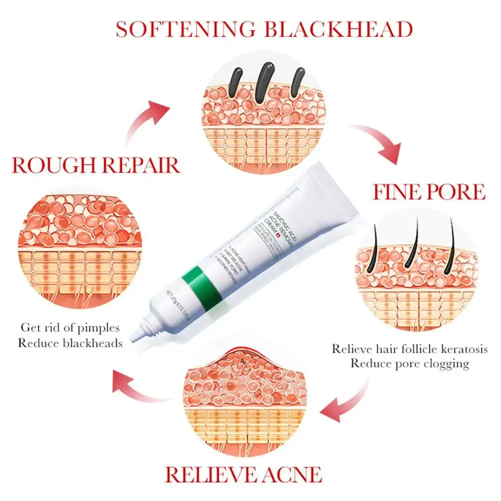 Salicylic Acid Shrink Pore Cream Elimination Large Pores Remove Blackehead Face Smooth Repairing Skin Care Product