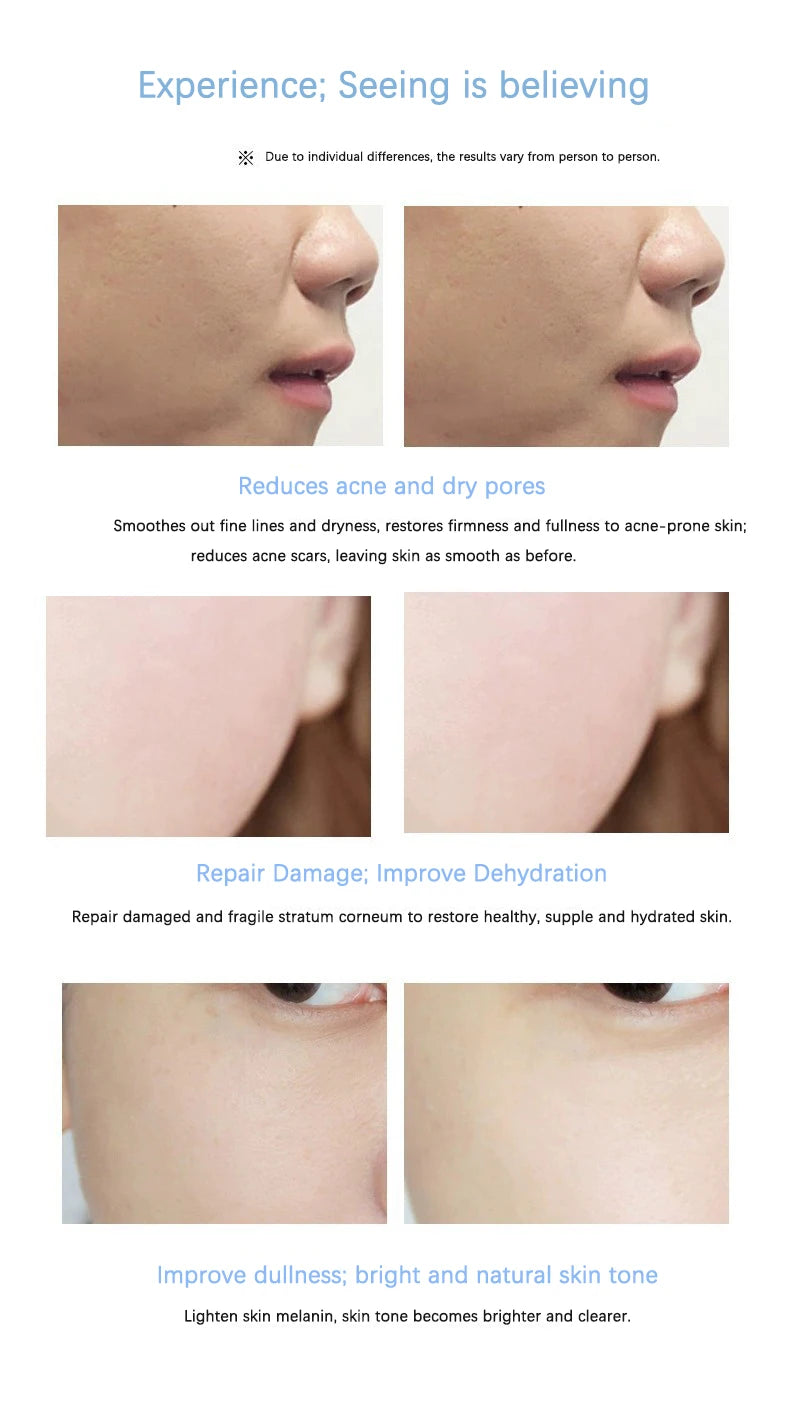Facial Polypeptide Freeze-dried Powder Skin Booster 0.25mm Microneedle Serum Hydration Brightening Improve Elasticity Skin Care