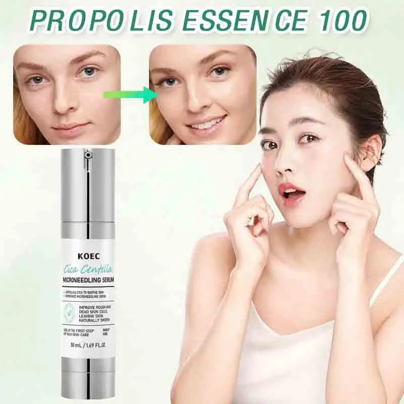 Korean Microneedle Essence Desalination Fine Lines Spots Collagen Solution Reverse Aging Recombinant Improves Rough Texture 50ml