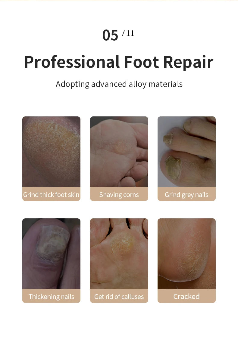 HOMEFISH Electric Foot Grinder Automatic Foot Callus Rubbing Pedicure Dead Skin Callus Remover for  Foot Beauty Machine