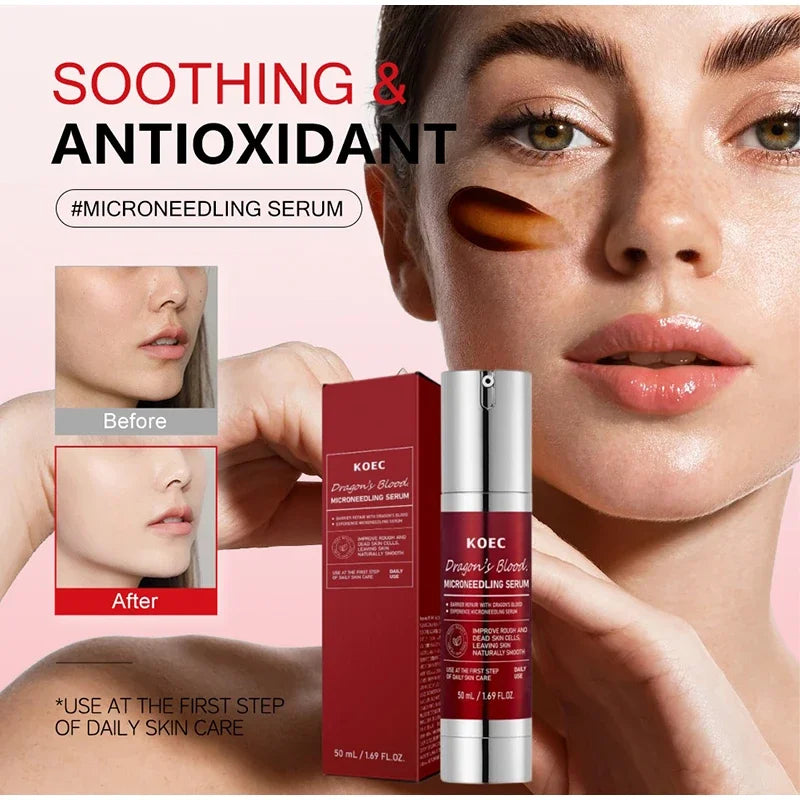 Soothing Microneedle Serum, Centella Asiatica & Propolis For Skin Barrier, Pore Care Exfoliating Korean Glass Skin Essence 50g