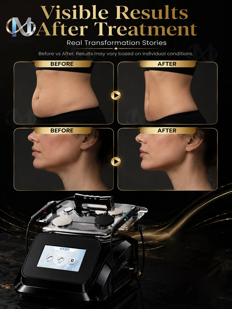 2026New 448KHZ INDIBA Tecar Therapy Machine Physiotherapy Pain Relief Body Slimming Skin Rejuvenation Salon SPA Beauty Equipment