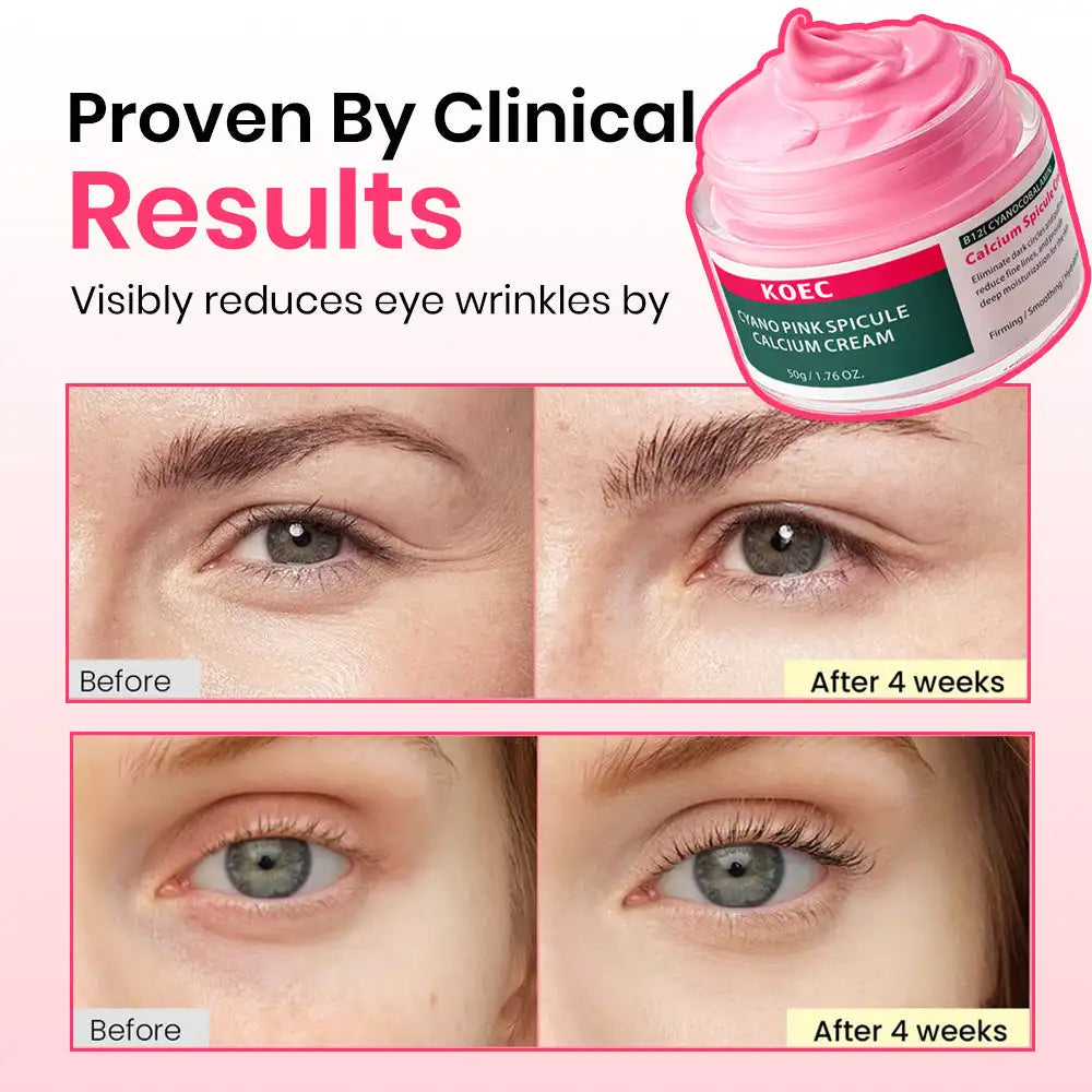 50g KOEC Pink Spicule Microneedling Calcium Eye Cream Firming Hydrating Eliminate Dark Circles Fine Lines Collagen Vitamin B12