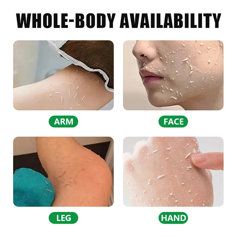 Korean Mandelic Acid Exfoliating Gel Deeply Cleanses Pores On Face Body Gently Removes Dead Skin Improves Facial Skin Texture