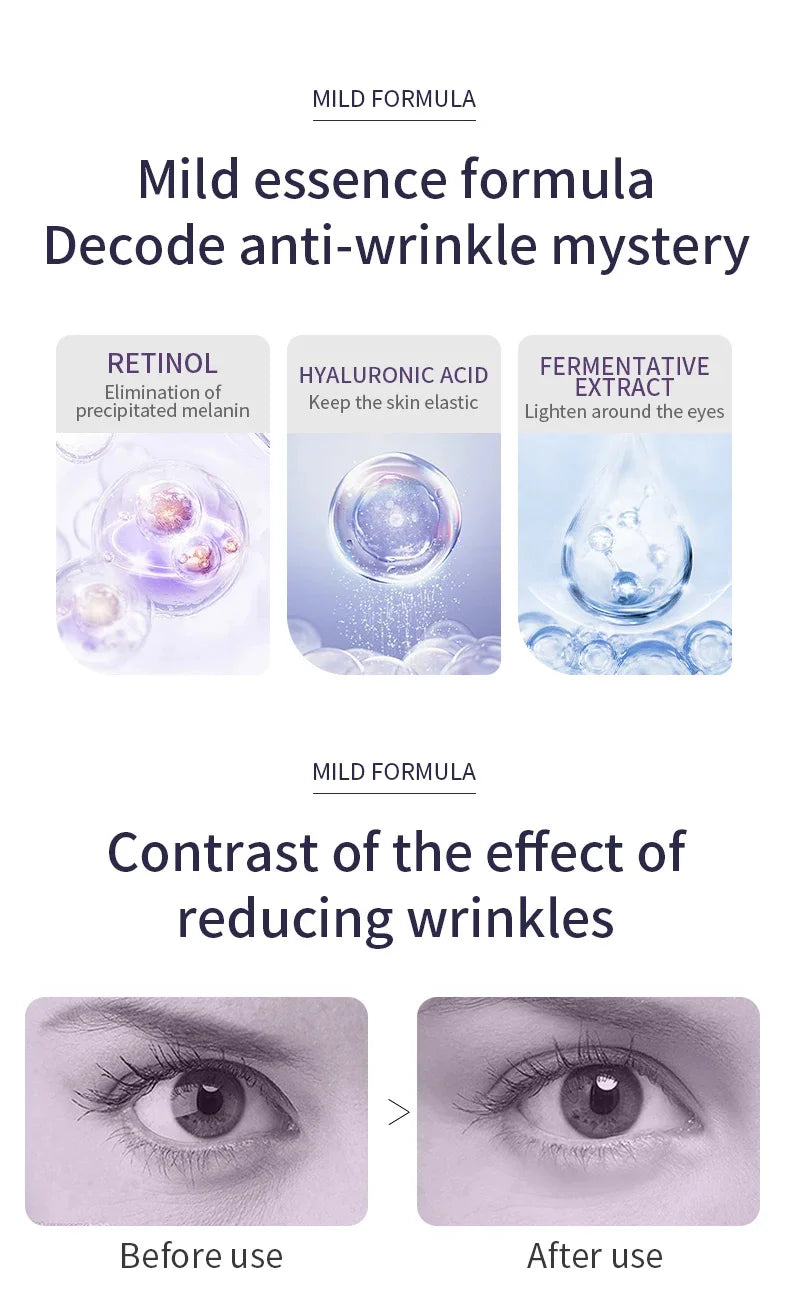 Anti Wrinkle Anti Dark Circle Eye Cream Roller Massager Moisturizing Eye Bags  Retinol Anti Aging Eye SkinCare Products O'CHEAL