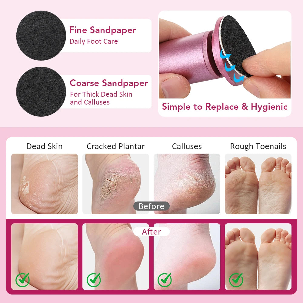 Electric Foot Callus Remover Foot Care File Heels Dead Skin Pedicure Tool Electronic Foot Grinder and Replacement Sandpaper
