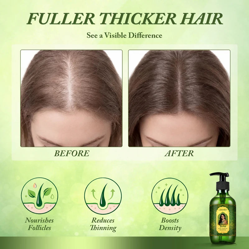 Shampoo Anti-Hair Loss & Hair Regrowth Strengthens Hair Controls Oil Refreshes Adds Volume Scalp Care Products for Family 300ml