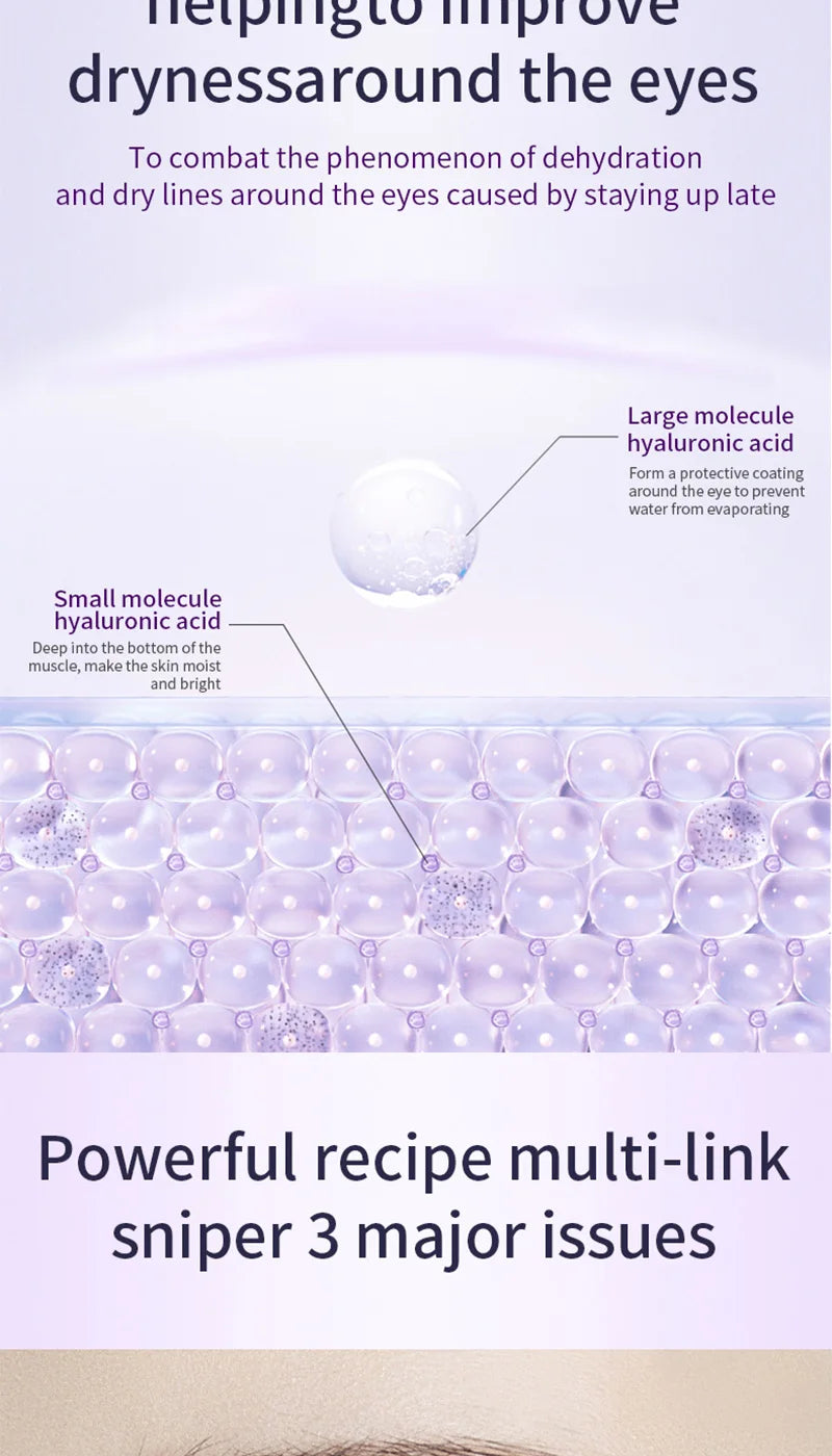 Ocheal Rolling Ball Eye Cream, Rolling Ball Massage Eye Cream, Moisturizing and Nourishing Eye Essence, Reduces Eye Wrinkles and Bags, Suitable for Both Men and Women, a Must-Have for Autumn and Winter.