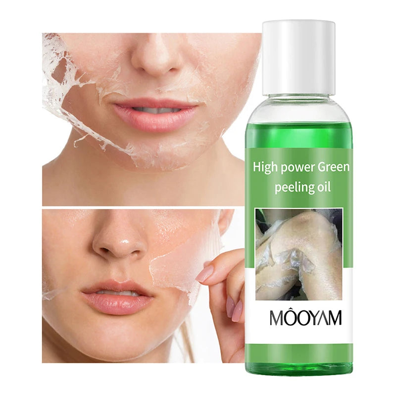 Salicylic Acid Peel-off Exfoliating Oil Removes Dead Skin From Face And Body Softens Cuticles Deeply Cleanses Without Irritation