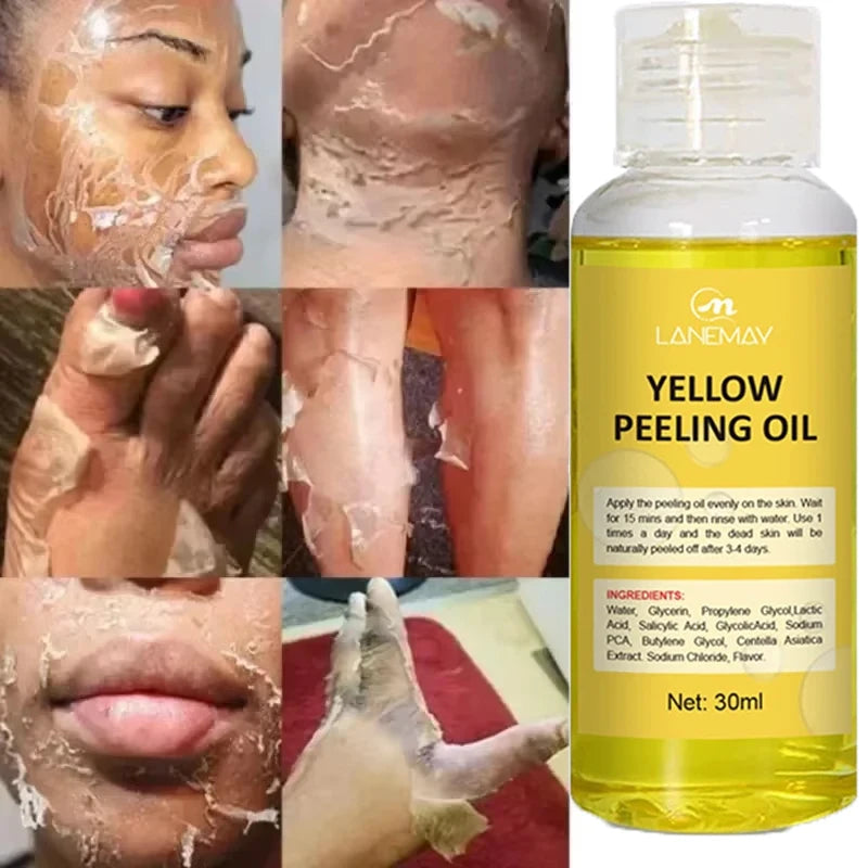 Yellow Peeling Oil Body Cleansing Exfoliation For Tender Glowing Skin Finger Joint Whitening Moisturizing Care Beauty Products
